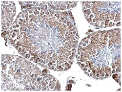 DGAT2 Polyclonal Antibody, Invitrogen 100&mu;L; Unlabeled:Antibodies, Polyclonal