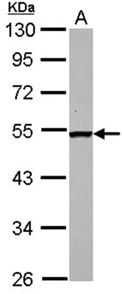 DGAT2 Polyclonal Antibody, Invitrogen 100&mu;L; Unlabeled:Antibodies, Polyclonal