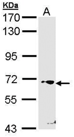 ROR gamma Polyclonal Antibody, Invitrogen 100&mu;L; Unlabeled:Antibodies,