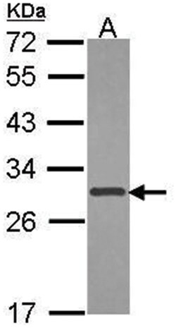 XPA Polyclonal Antibody, Invitrogen 100&mu;L; Unlabeled:Antibodies, Polyclonal