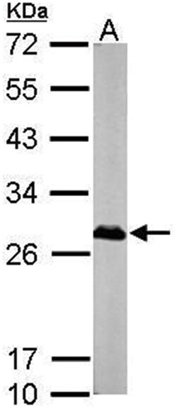 XPA Polyclonal Antibody, Invitrogen 100&mu;L; Unlabeled:Antibodies, Polyclonal