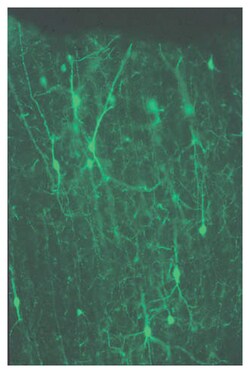 MilliporeSigma anti-Calretinin, Clone: 6B8.2, (Chemicon ) 100&mu;g:Antibodies,