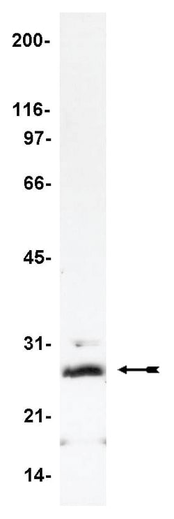 MilliporeSigma anti-Phospholamban, Clone: A1, (Upstate ) 50&mu;g; Unlabeled:Antibodies,