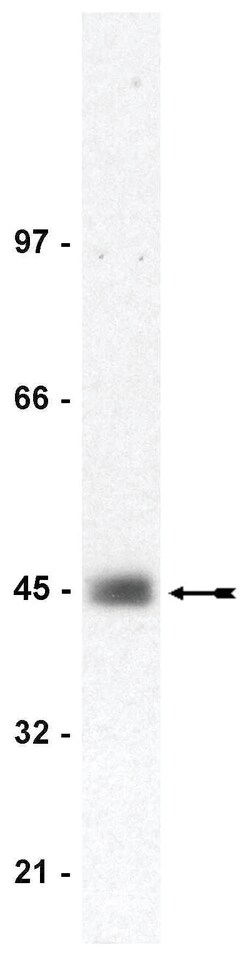 MilliporeSigma anti-CAR, Clone: RmcB, (Upstate ) 200&mu;g; Unlabeled:Antibodies,