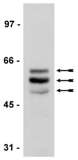 MilliporeSigma anti-Tau (4-repeat isoform RD4), Clone: 1E1/A6, (Upstate