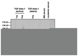 TGF beta-1 Polyclonal Antibody, Invitrogen 100&mu;g; Unlabeled:Antibodies,