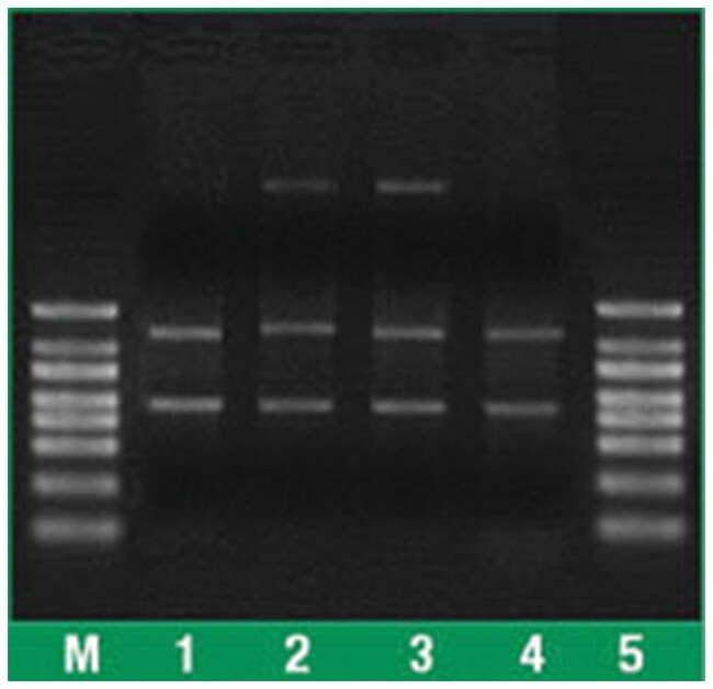 Thermo Scientific GeneJET Whole Blood RNA Purification Mini Kit For 50