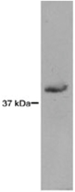 RAD51L3, Mouse, Clone: 5B3/6, Abnova 100&mu;L; Unlabeled:Antibodies, Monoclonal