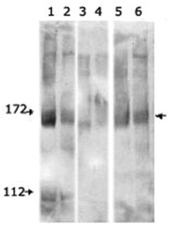 Mouse anti-FANCD2, Clone: FI-17, Abnova 100&mu;L:Antibodies, Monoclonal