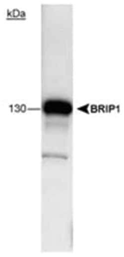 BRIP1, Mouse, Clone: pp15-IB4, Abnova 100 &mu;L | Buy Online | Abnova | Fisher Scientific