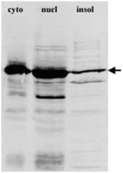 TNPO1, Mouse, Clone: D45, Abnova 100&mu;L; Unlabeled:Antibodies, Monoclonal