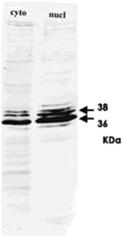 HNRNPA2B1, Mouse, Clone: DP3B3, Abnova 100 &mu;L | Buy Online | Abnova Corporation | Fisher Scientific
