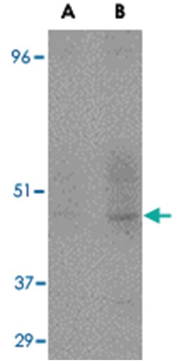 CD209, Mouse, Clone: 5D7, Abnova 100 &mu;g | Buy Online | Abnova | Fisher Scientific