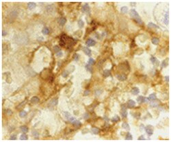 CD209, Mouse, Clone: 5D7, Abnova 100 &mu;g | Buy Online | Abnova | Fisher Scientific