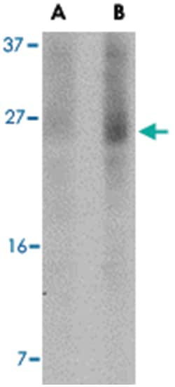 BBC3, Mouse, Clone: 2A9G5, Abnova 100&mu;g; Unlabeled:Antibodies, Monoclonal