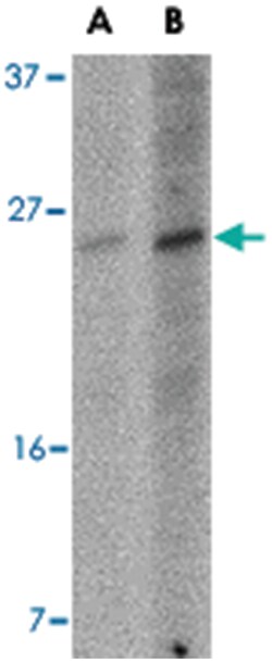 BBC3, Mouse, Clone: 10D4G7, Abnova 100&mu;g; Unlabeled:Antibodies, Monoclonal