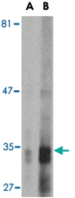 ENDOG, Mouse, Clone: 7G1C10, Abnova 100&mu;g; Unlabeled:Antibodies, Monoclonal