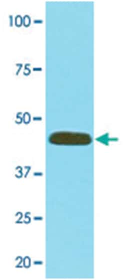 MAT2A, Mouse, Clone: AT3A2, Abnova 100 &mu;L | Buy Online | Abnova | Fisher Scientific