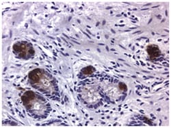 MMP9, Mouse, Clone: SB15c, Abnova 100&mu;g; Unlabeled:Antibodies, Monoclonal