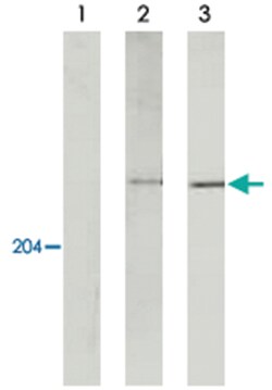 Myh11, Rat, Clone: KM3669, Abnova 100&mu;g; Unlabeled:Antibodies, Monoclonal