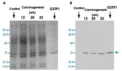 GSTP1, Mouse, Clone: Usal-hGST-Pi-McAb-1, Abnova 100&mu;g; Unlabeled:Antibodies,