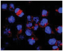 Kinesin (heavy chain), Mouse, Clone: KN-03, Abnova 100&mu;g; Unlabeled:Antibodies,