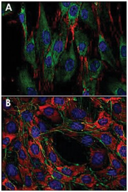 SOS1, Mouse, Clone: SOS-01, Abnova 100&mu;g; Unlabeled:Antibodies, Monoclonal