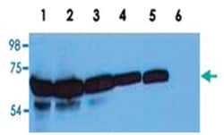 ZAP70, Mouse, Clone: ZAP-03, Abnova 100&mu;g; Unlabeled:Antibodies, Monoclonal