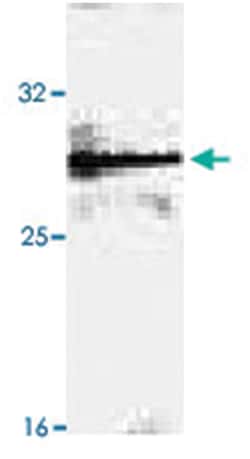 Tollip, Rat, Clone: Kimmy-1, Abnova 100&mu;g; Unlabeled:Antibodies, Monoclonal