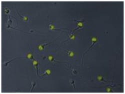 ACRV1, Mouse, Clone: Hs-14, Abnova 100&mu;g; Unlabeled:Antibodies, Monoclonal
