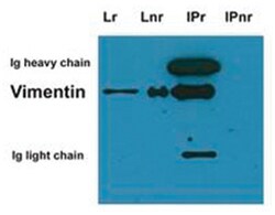 VIM, Mouse, Clone: VI-01, Abnova 100&mu;g; Unlabeled:Antibodies, Monoclonal