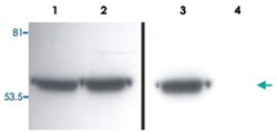 VIM, Mouse, Clone: VI-01, Abnova 100&mu;g; Unlabeled:Antibodies, Monoclonal