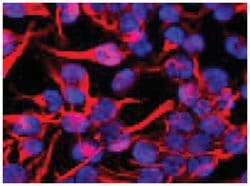 VIM, Mouse, Clone: VI-01, Abnova 100&mu;g; Unlabeled:Antibodies, Monoclonal