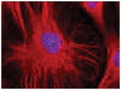 VIM, Mouse, Clone: VI-01, Abnova 100&mu;g; Unlabeled:Antibodies, Monoclonal