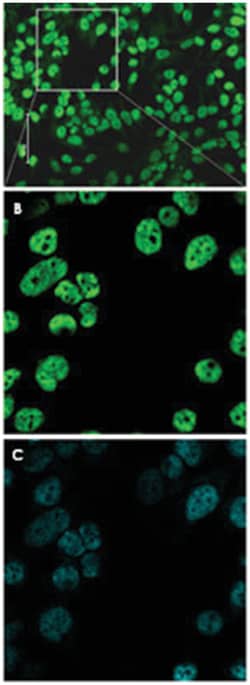 5-methyl Cytidine, Mouse, Clone: 33D3, Abnova 100 &mu;g | Buy Online | Abnova Corporation | Fisher Scientific