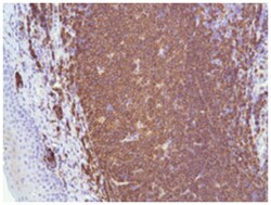 MS4A1, Rabbit, Clone: SP32, Abnova 100 &mu;L | Buy Online | Abnova Corporation | Fisher Scientific