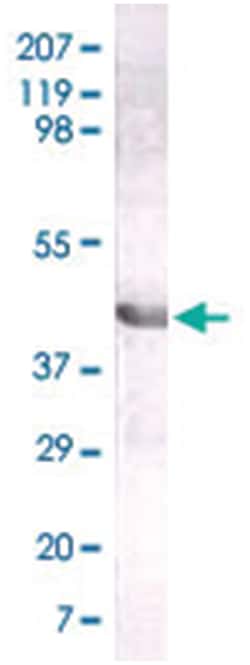 LIPA, Mouse, Clone: 9G7F12, Abnova 100&mu;g; Unlabeled:Antibodies, Monoclonal