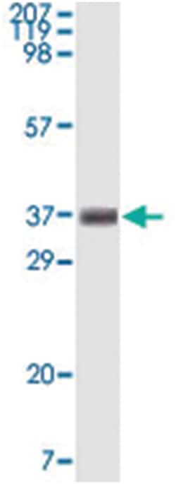 BCL10, Mouse, Clone: 4F8E8H8, Abnova 100&mu;g; Unlabeled:Antibodies, Monoclonal