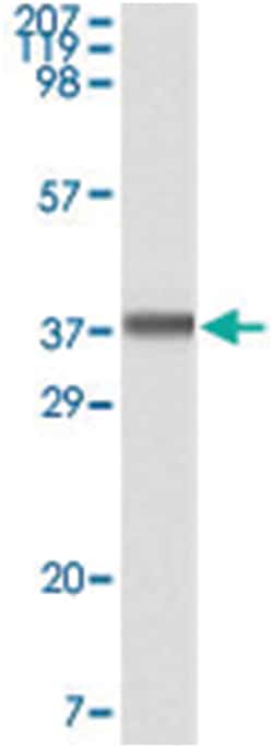 BLK Mouse anti-Human, Clone: 9D10A8F8, Abnova 100 &mu;L | Buy Online | Abnova Corporation | Fisher Scientific