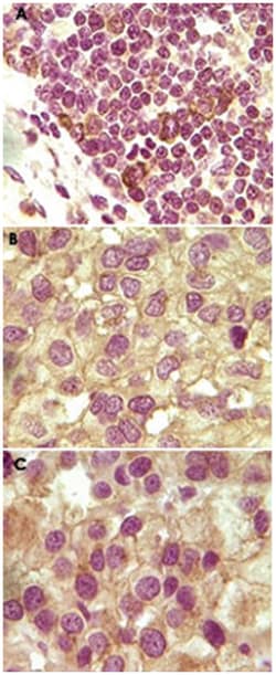 INHA, Mouse, Clone: 4A2A9, 4A2F7, 4A2F2, Abnova 100 &mu;g | Buy Online | Abnova | Fisher Scientific