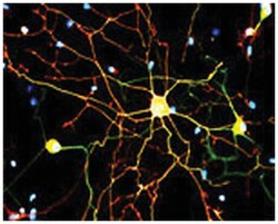 Ngfr, Mouse, Clone: MC192, Abnova 100&mu;g; Unlabeled:Antibodies, Monoclonal