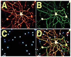 Ngfr, Mouse, Clone: MC192, Abnova 100&mu;g; Unlabeled:Antibodies, Monoclonal