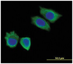 KRT8/KRT18, Mouse, Clone: CK8+18 207, Abnova 500&mu;L; Unlabeled:Antibodies,