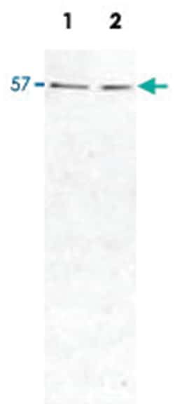 HIP1R, Mouse, Monoclonal Antibody, Abnova 100&mu;L; Unlabeled:Antibodies,