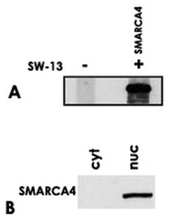 SMARCA4, Mouse, Clone: BRG-01, Abnova 100&mu;g; Unlabeled:Antibodies, Monoclonal