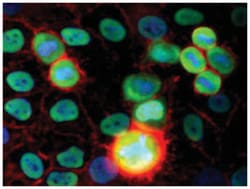 XRCC5, Mouse, Clone: MEM-54, Abnova 100&mu;g; Unlabeled:Antibodies, Monoclonal