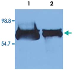 ALB, Mouse, Biotin, Clone: AL-01, Abnova 100&mu;g; Biotin:Anticuerpos