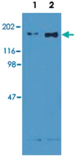EGFR, Mouse, Clone: EM-13, Abnova 100 &mu;g | Buy Online | Abnova Corporation | Fisher Scientific