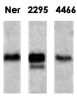 CaMKII, Mouse, Clone: 22B1, Abnova 100&mu;g; Unlabeled:Antibodies, Monoclonal