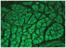 CaMKII, Mouse, Clone: 22B1, Abnova 100&mu;g; Unlabeled:Antibodies, Monoclonal
